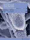 The International Journal of Oral and Maxillofacial Implants