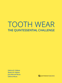 Tooth Wear: The Quintessential Challenge